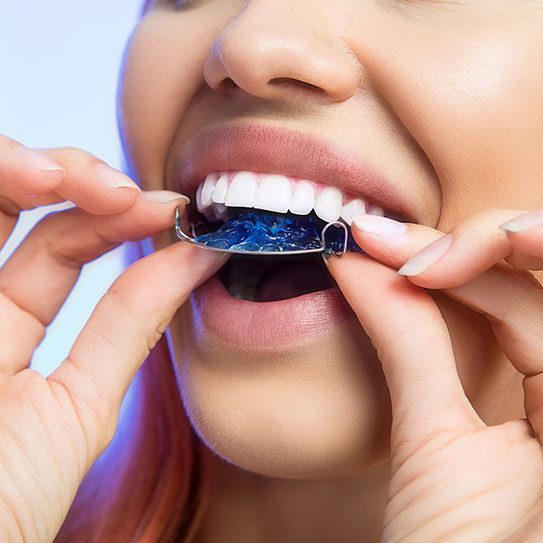 Tips for Aftercare in Orthodontic Treatment - MyOrthodontist - aftercare,tips for aftercare tips for aftercare